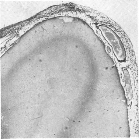 https://cdn.ncbi.nlm.nih.gov/pmc/blobs/cf5e/1926148/df4775b00f1a/brmedj02989-0026-g.jpg