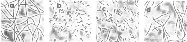 https://cdn.ncbi.nlm.nih.gov/pmc/blobs/cf5f/453190/be51f363ad4b/emboj00111-0376-a.jpg
