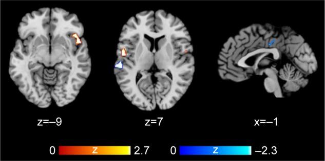 https://cdn.ncbi.nlm.nih.gov/pmc/blobs/cf69/6432899/8a8cd4f27d04/ndt-15-721Fig2.jpg