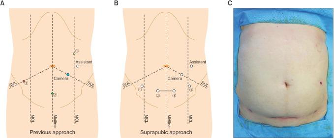 https://cdn.ncbi.nlm.nih.gov/pmc/blobs/cf74/5801332/d6a355448e62/astr-94-83-g001.jpg