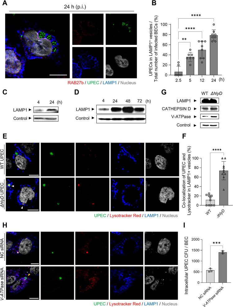 https://cdn.ncbi.nlm.nih.gov/pmc/blobs/cf77/10204954/b967b851ea2f/ppat.1011388.g004.jpg