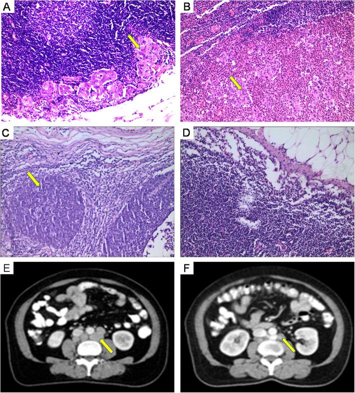 https://cdn.ncbi.nlm.nih.gov/pmc/blobs/cf7b/8088051/c29dbeff1600/12885_2021_8208_Fig2_HTML.jpg