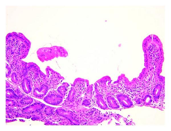 https://cdn.ncbi.nlm.nih.gov/pmc/blobs/cf87/3485763/4da42faee413/CRIM.PEDIATRICS2012-624168.003.jpg
