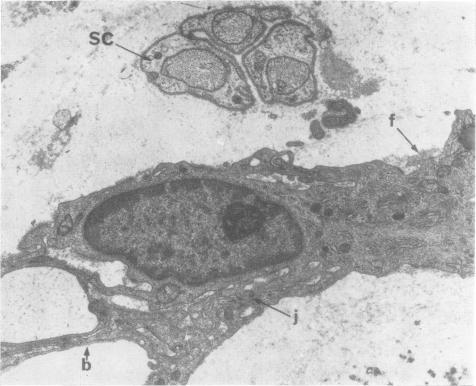https://cdn.ncbi.nlm.nih.gov/pmc/blobs/cf89/1083599/3dbdc638dc76/jnnpsyc00204-0098-a.jpg