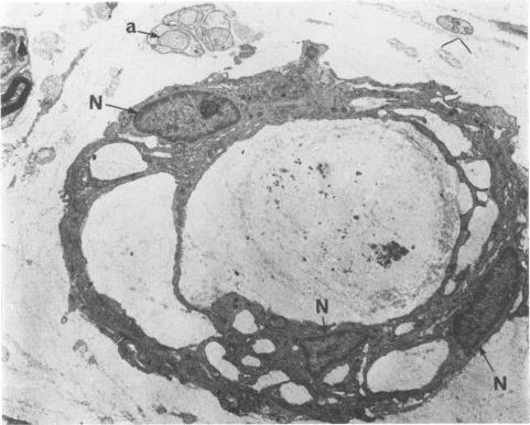 https://cdn.ncbi.nlm.nih.gov/pmc/blobs/cf89/1083599/d5c4df639cd0/jnnpsyc00204-0097-a.jpg