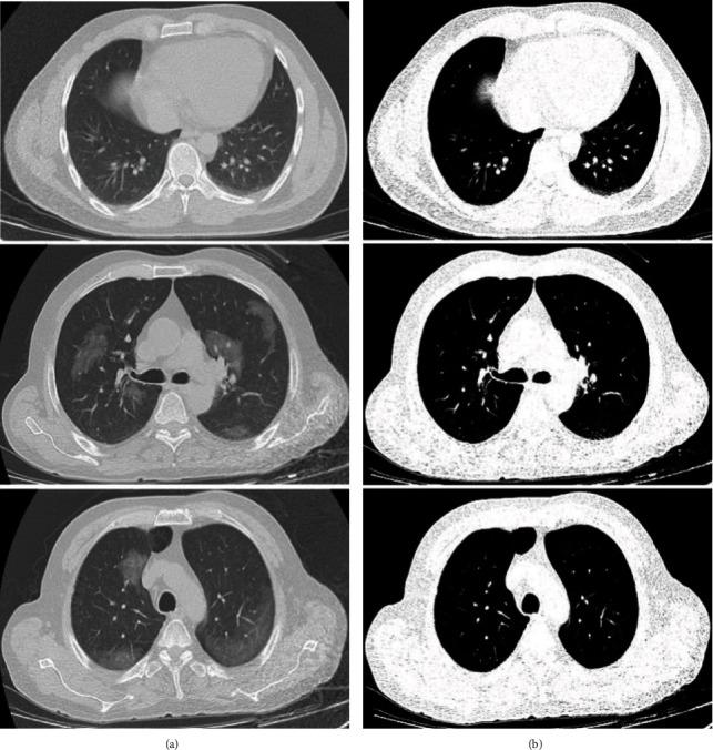 https://cdn.ncbi.nlm.nih.gov/pmc/blobs/cf8e/8054863/5c01b50dd2c3/BMRI2021-5544742.002.jpg