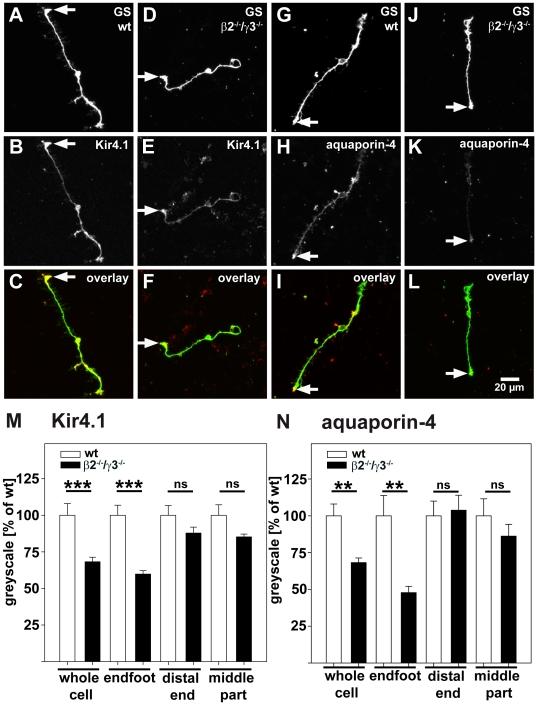 https://cdn.ncbi.nlm.nih.gov/pmc/blobs/cf91/3025027/42a17d04c44d/pone.0016106.g002.jpg