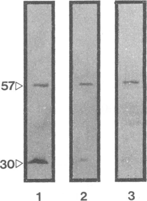 https://cdn.ncbi.nlm.nih.gov/pmc/blobs/cfa9/186066/a08a63469352/iai00001-0078-a.jpg
