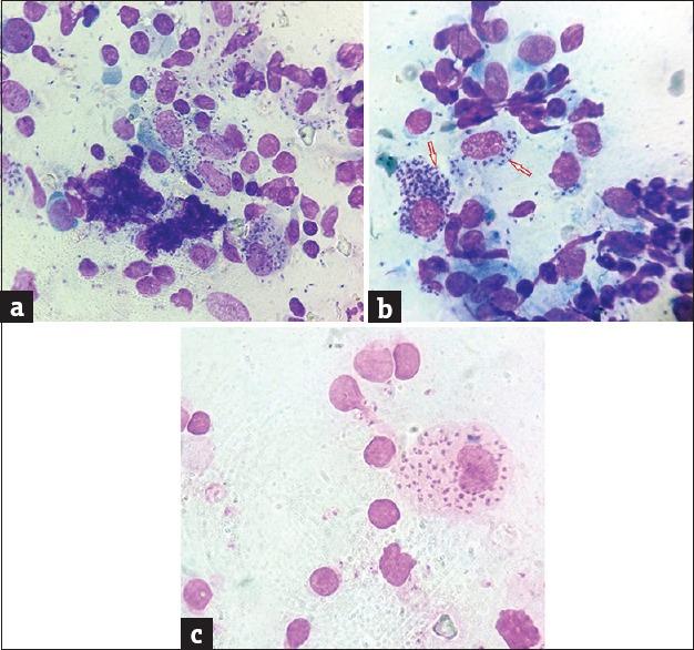 https://cdn.ncbi.nlm.nih.gov/pmc/blobs/cfab/5618855/c02514bafd8c/IJD-62-548b-g003.jpg