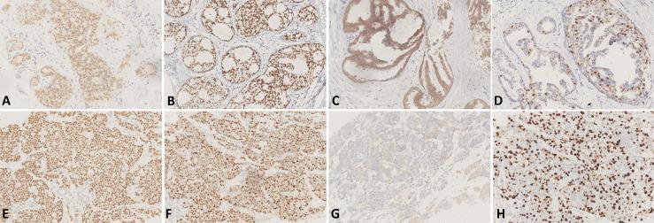 https://cdn.ncbi.nlm.nih.gov/pmc/blobs/cfab/9035873/2c63683f7456/fonc-12-855899-g001.jpg