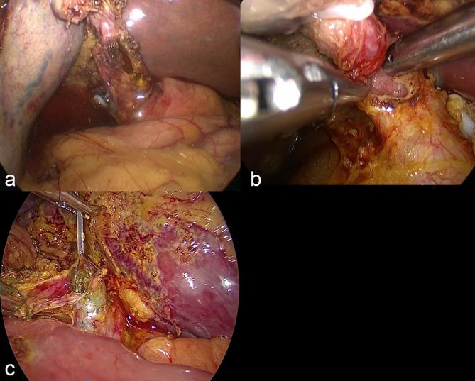 https://cdn.ncbi.nlm.nih.gov/pmc/blobs/cfb0/12210935/7c05bcb70422/12876_2025_4063_Fig3_HTML.jpg