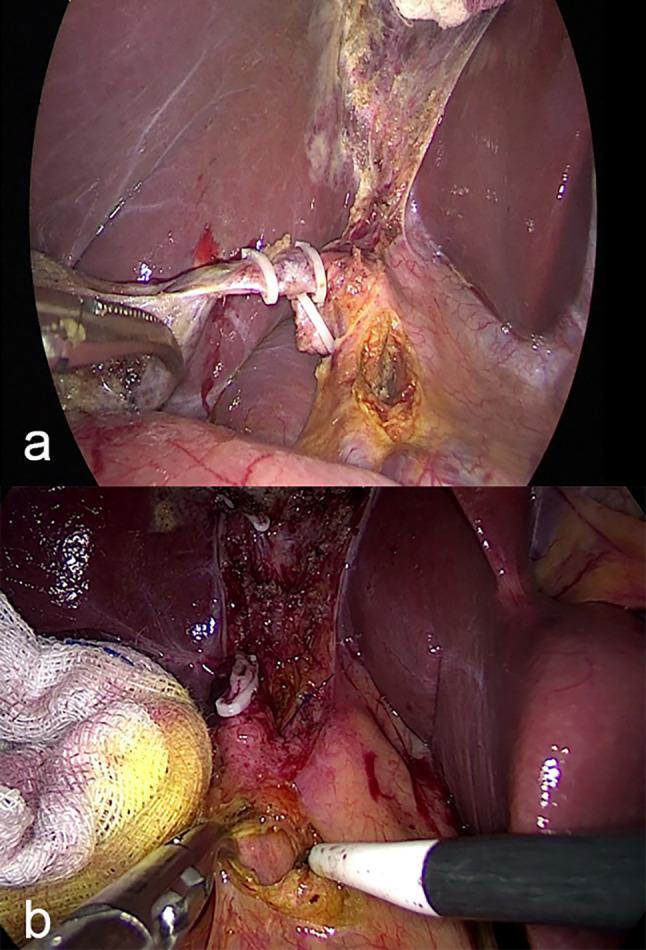 https://cdn.ncbi.nlm.nih.gov/pmc/blobs/cfb0/12210935/c549957a9967/12876_2025_4063_Fig6_HTML.jpg