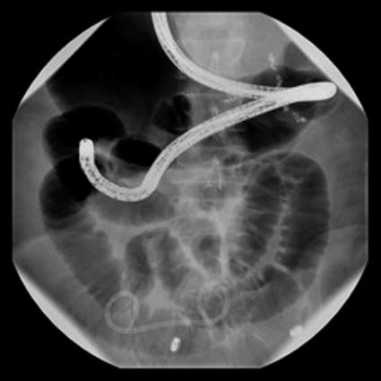 https://cdn.ncbi.nlm.nih.gov/pmc/blobs/cfb2/3148878/bf63c6926c8b/jls0021127390003.jpg