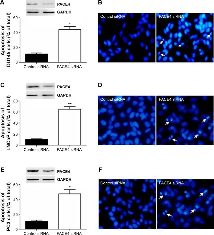 https://cdn.ncbi.nlm.nih.gov/pmc/blobs/cfb5/4639519/96b79bd1971d/dddt-9-5911Fig3.jpg