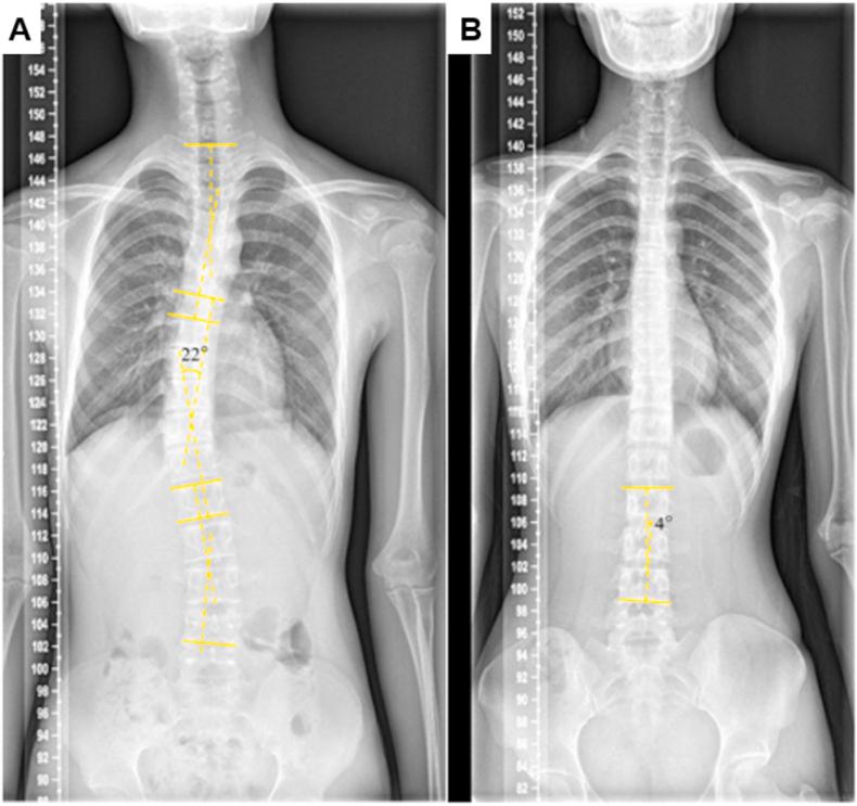 https://cdn.ncbi.nlm.nih.gov/pmc/blobs/cfba/7972962/4fee02c0a76f/gr6.jpg