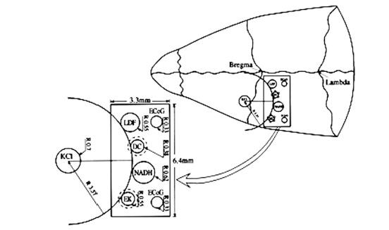 https://cdn.ncbi.nlm.nih.gov/pmc/blobs/cfc7/3367297/974e8908dda6/TONEUJ-6-6_F1.jpg