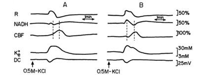 https://cdn.ncbi.nlm.nih.gov/pmc/blobs/cfc7/3367297/af265e5c5188/TONEUJ-6-6_F4.jpg