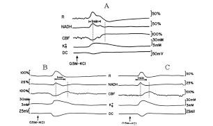 https://cdn.ncbi.nlm.nih.gov/pmc/blobs/cfc7/3367297/bf1773a606f6/TONEUJ-6-6_F6.jpg