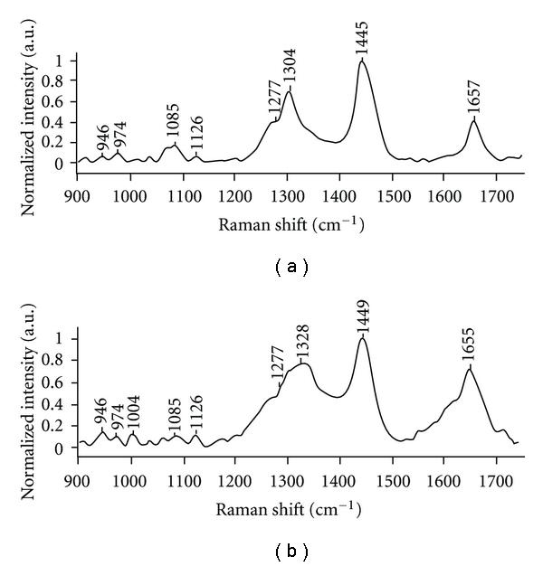 https://cdn.ncbi.nlm.nih.gov/pmc/blobs/cfcd/3143435/0cbec0a16a40/PRI2011-632493.004.jpg