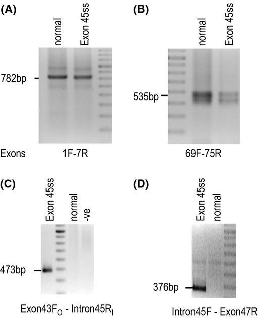 https://cdn.ncbi.nlm.nih.gov/pmc/blobs/cfce/3865583/46869048608e/mgg30001-0162-f5.jpg