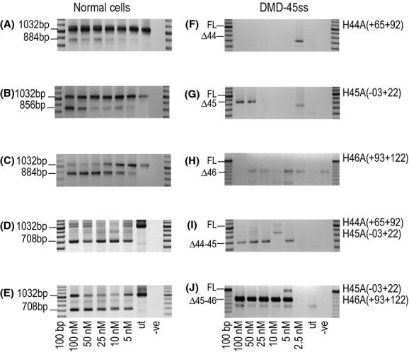 https://cdn.ncbi.nlm.nih.gov/pmc/blobs/cfce/3865583/59b8fba06a96/mgg30001-0162-f6.jpg