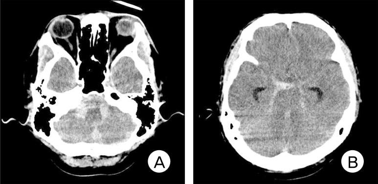 https://cdn.ncbi.nlm.nih.gov/pmc/blobs/cfcf/3625817/707a9f7197be/jcen-15-26-g001.jpg
