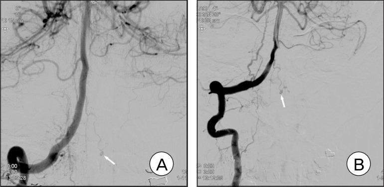 https://cdn.ncbi.nlm.nih.gov/pmc/blobs/cfcf/3625817/81492f48dd09/jcen-15-26-g003.jpg
