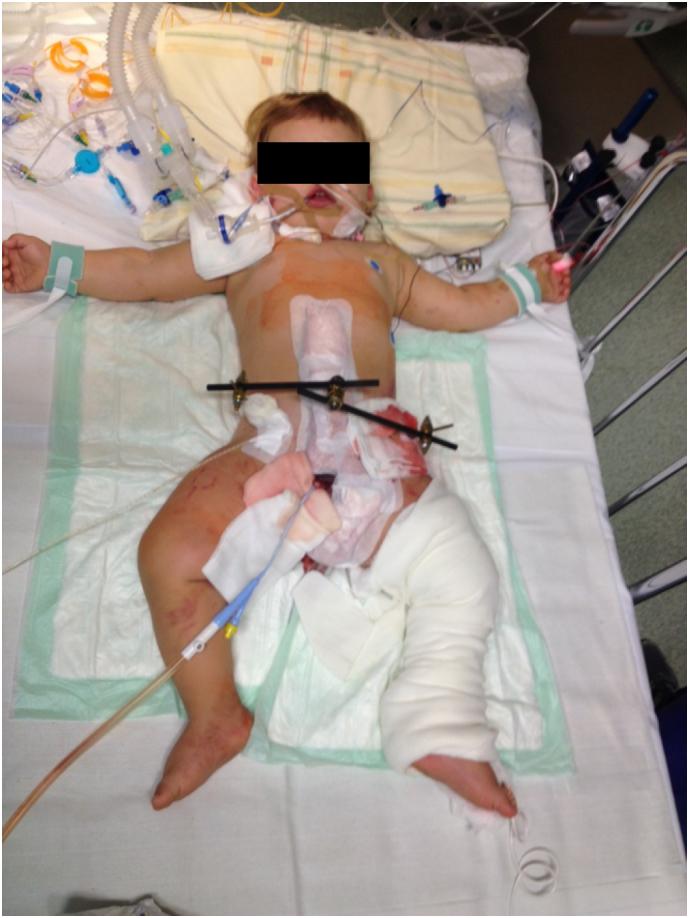 https://cdn.ncbi.nlm.nih.gov/pmc/blobs/cfd0/6593344/5fb325f77547/gr4.jpg