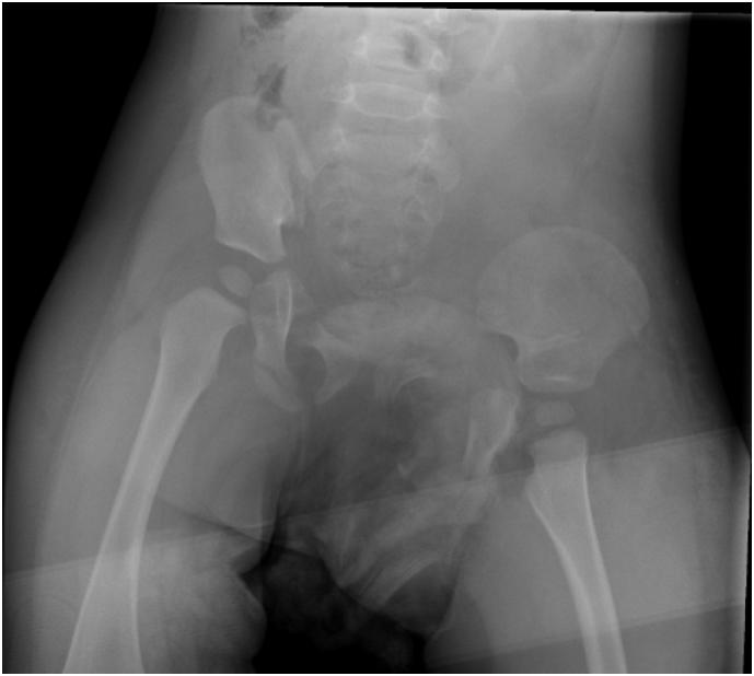 https://cdn.ncbi.nlm.nih.gov/pmc/blobs/cfd0/6593344/73d7afd6df21/gr1.jpg