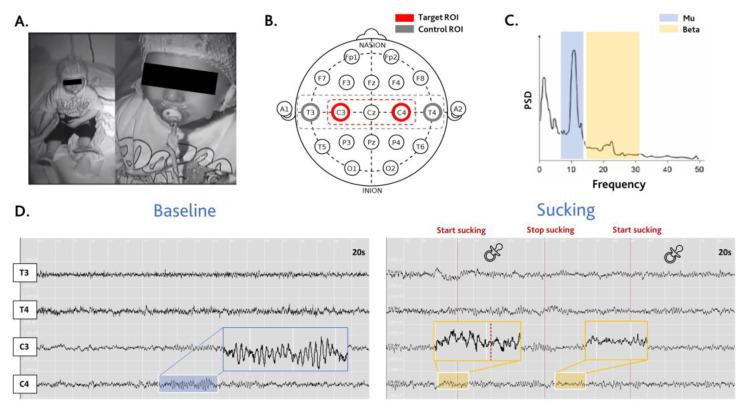 https://cdn.ncbi.nlm.nih.gov/pmc/blobs/cfd1/11047852/22d866003eab/brainsci-14-00402-g001.jpg