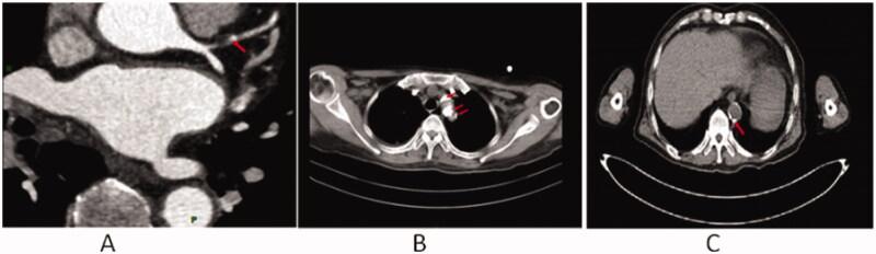 https://cdn.ncbi.nlm.nih.gov/pmc/blobs/cfd6/8856035/a56e3b2e33d2/IRNF_A_2032742_F0003_C.jpg