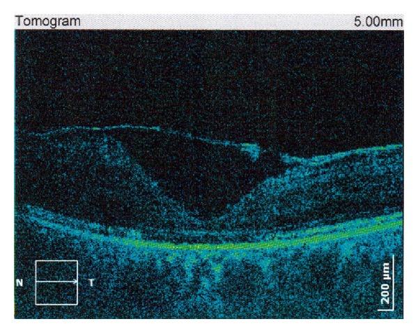 https://cdn.ncbi.nlm.nih.gov/pmc/blobs/cfd7/4207459/2d29a85e2751/CRII2014-876525.005.jpg