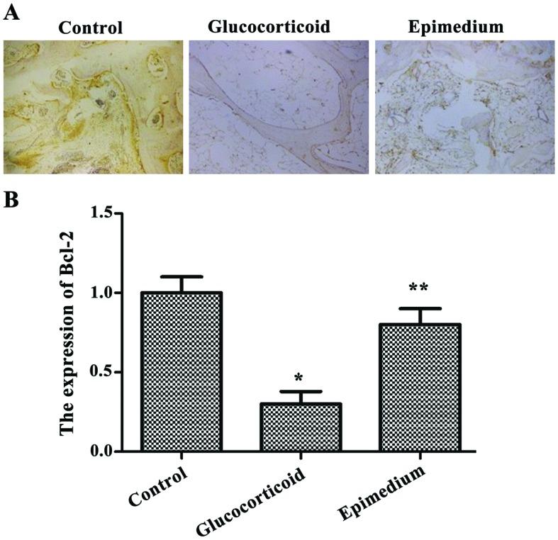 https://cdn.ncbi.nlm.nih.gov/pmc/blobs/cfdd/6257266/bb7b097511df/etm-16-06-5047-g01.jpg