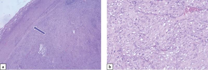 https://cdn.ncbi.nlm.nih.gov/pmc/blobs/cfdf/11145578/7fdecc72e67f/problendo-70-13345-g008.jpg
