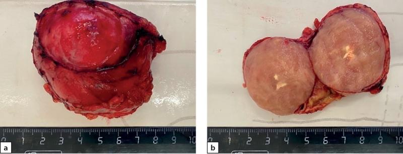 https://cdn.ncbi.nlm.nih.gov/pmc/blobs/cfdf/11145578/867573475ebd/problendo-70-13345-g007.jpg