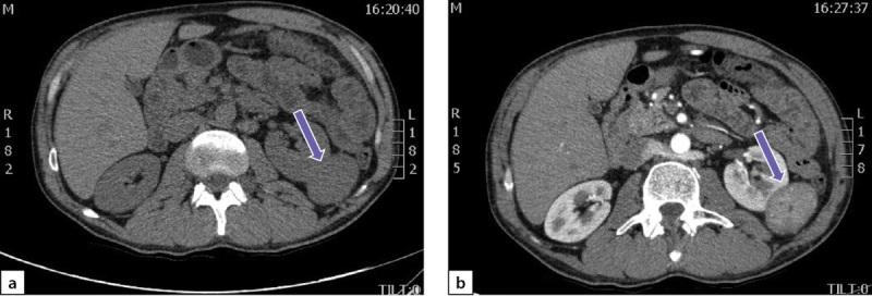 https://cdn.ncbi.nlm.nih.gov/pmc/blobs/cfdf/11145578/bb08766283ee/problendo-70-13345-g006.jpg