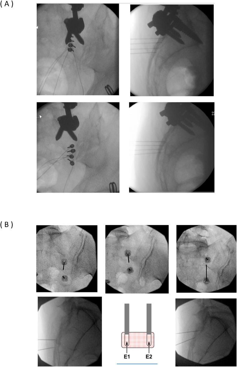 https://cdn.ncbi.nlm.nih.gov/pmc/blobs/cfe4/11372946/97b8dec62a8c/gr2a.jpg