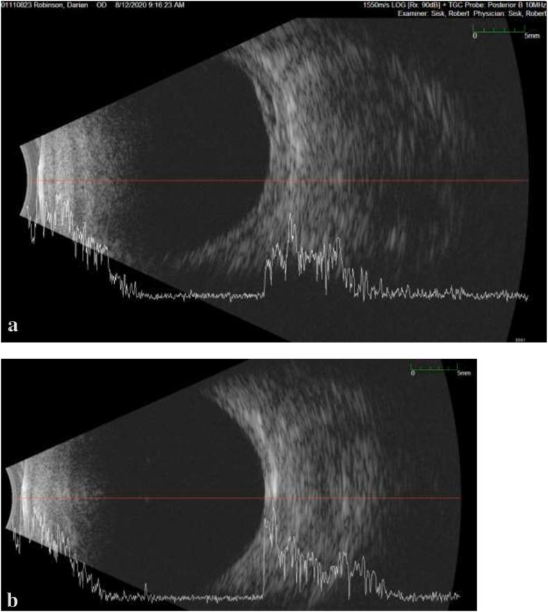 https://cdn.ncbi.nlm.nih.gov/pmc/blobs/cfe7/9396541/5c122b455a65/gr2.jpg