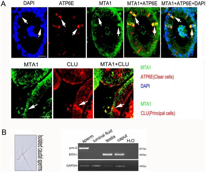 https://cdn.ncbi.nlm.nih.gov/pmc/blobs/cff2/2972736/245ea912f18c/pone.0015439.g003.jpg