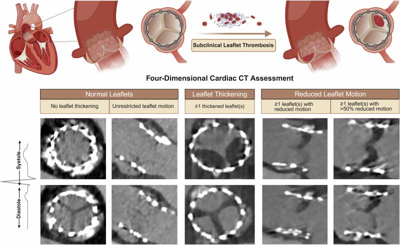 https://cdn.ncbi.nlm.nih.gov/pmc/blobs/cff4/12259991/b0a4cc160611/41467_2025_61916_Fig4_HTML.jpg