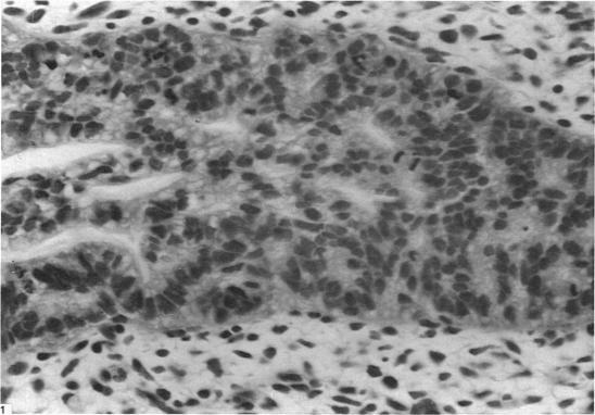 https://cdn.ncbi.nlm.nih.gov/pmc/blobs/cff8/1262064/93af0f2b7657/janat00172-0212-a.jpg