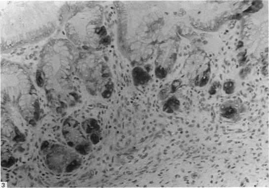 https://cdn.ncbi.nlm.nih.gov/pmc/blobs/cff8/1262064/eaaa4bebc2bd/janat00172-0214-a.jpg