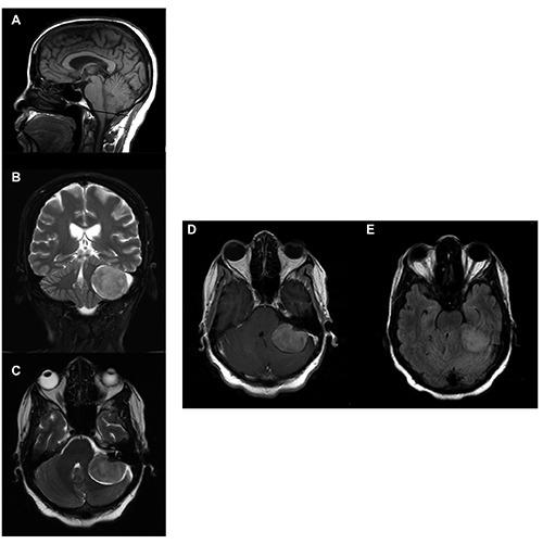 https://cdn.ncbi.nlm.nih.gov/pmc/blobs/cff9/6444560/69290486c7f8/ni-11-1-7815-g001.jpg