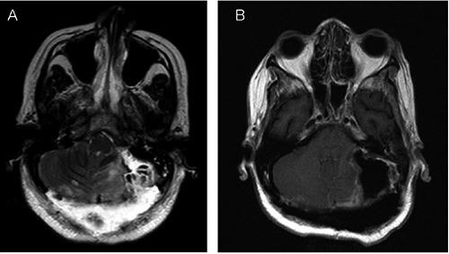 https://cdn.ncbi.nlm.nih.gov/pmc/blobs/cff9/6444560/7802a6bb6f3a/ni-11-1-7815-g003.jpg