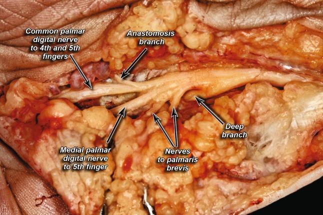 https://cdn.ncbi.nlm.nih.gov/pmc/blobs/cffc/5250657/93e1bbbe4d1c/402_2016_2616_Fig6_HTML.jpg