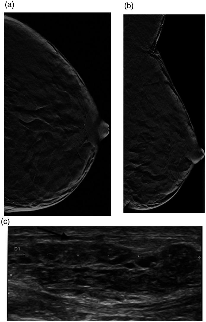 https://cdn.ncbi.nlm.nih.gov/pmc/blobs/cffd/8114760/0d060896d3b9/10.1177_20584601211013501-fig3.jpg
