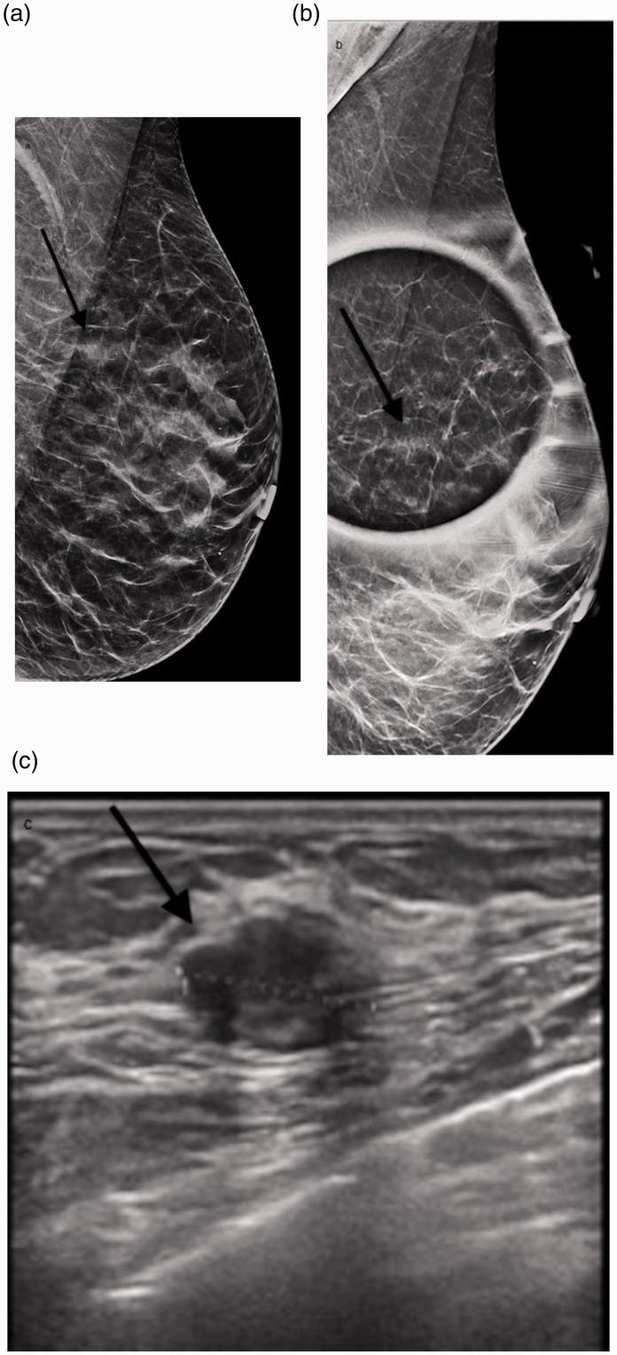 https://cdn.ncbi.nlm.nih.gov/pmc/blobs/cffd/8114760/13aece6c14b7/10.1177_20584601211013501-fig1.jpg