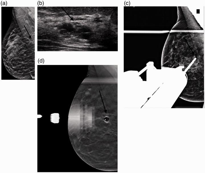 https://cdn.ncbi.nlm.nih.gov/pmc/blobs/cffd/8114760/6322a751461c/10.1177_20584601211013501-fig2.jpg