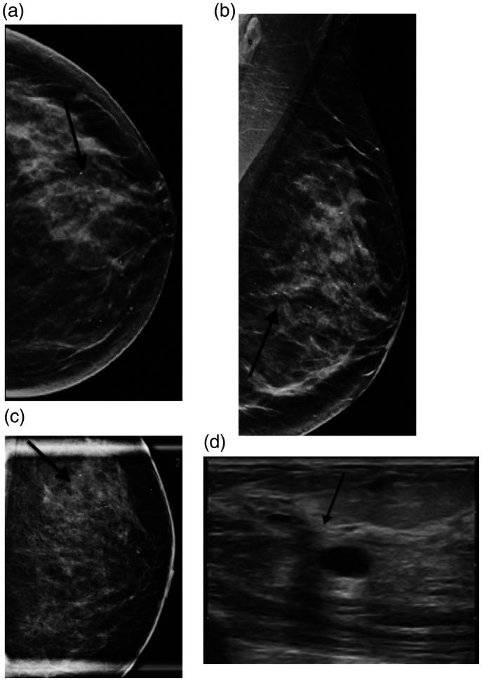 https://cdn.ncbi.nlm.nih.gov/pmc/blobs/cffd/8114760/c8c1154fc6a0/10.1177_20584601211013501-fig4.jpg