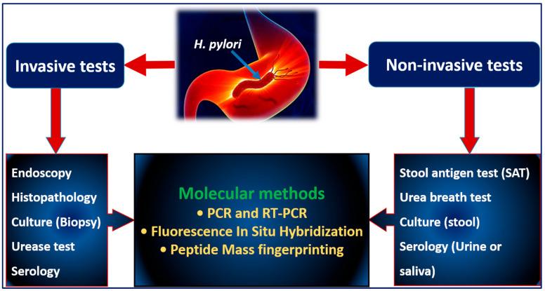 https://cdn.ncbi.nlm.nih.gov/pmc/blobs/d000/9952126/8874d35e7f63/antibiotics-12-00191-g002.jpg